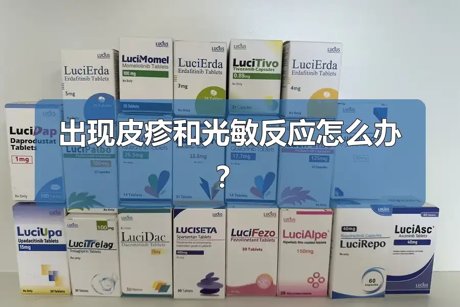 出现皮疹和光敏反应怎么办？